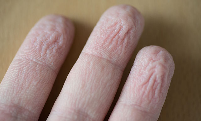 schrumpelige Finger